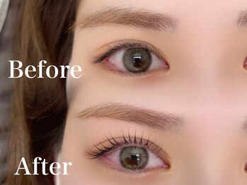 プラチナ 表参道(PLATINA)/ビフォーアフター