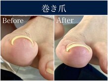 ドクターネイル爪革命 麻布十番店