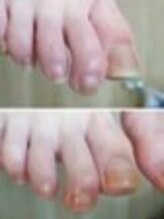 リゼラアンドコー 船橋店/ドイツ式フットケア専門店