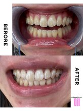 エクシアホワイトニング 王寺店/