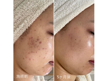 シェノンの写真