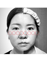 リアプア(Li'a)/たった１ヶ月半での変化　小顔