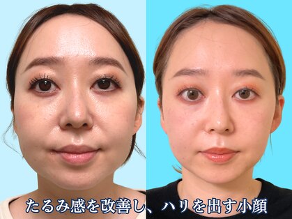 ナチュラルパーフェクトフェイス 新宿の写真