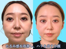 ナチュラルパーフェクトフェイス 新宿