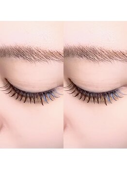 ロム フローラ(Rom Flora)/