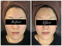 フェリーチェ 海老名(Felice)/