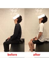 ナオル整体 福岡香椎院(NAORU整体)/30代男性施術事例【肩こり】