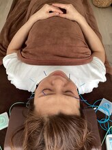 ハリファ鍼灸院 横浜関内院(HariFa鍼灸院)/美容施術