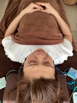 ハリファ鍼灸院 横浜関内院(HariFa鍼灸院)/美容施術