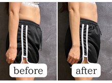 こもれび/1回の施術でこんなに変化が !!