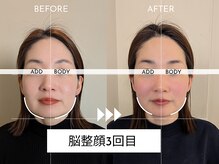 アドボディ(ADD BODY)/