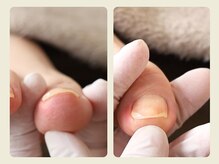 ルポ 伊勢/ご来店～施術終了までの流れ　9