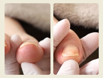 ルポ 伊勢/ご来店~施術終了までの流れ 9