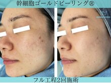 リメイククリニカルビューティー(Remake clinical beauty)/