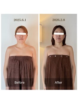 アリス(Alice)/骨格矯正+フェイシャル小顔矯正