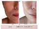 リアン(Lien)の写真/【見た目年齢に差がつく】筋膜リリース＆マシンで深部より引上げ！二重アゴにも◎目元もぱっちりモテ顔に
