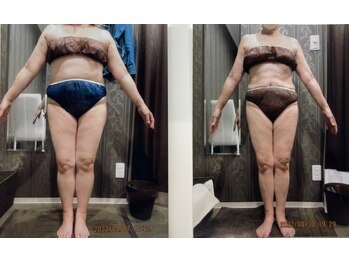 クイーン 札幌駅前店(Queen)/お客様 ビフォーアフター(7)