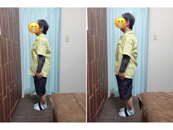 マリモ鍼灸接骨院/姿勢改善コース！