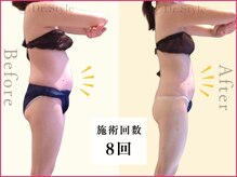 痩身エステ 美容整体 ドクタースタイル(Dr.Style)/最新痩身マシン&リンパ/岐阜