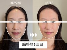 アドボディ(ADD BODY)/