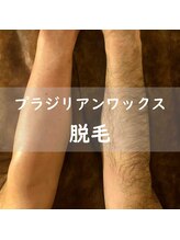 フォーチュンガーデン/プラジリアンワックス脱毛