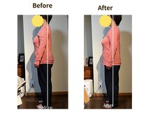 フェルナ(FERNA)/Before/After