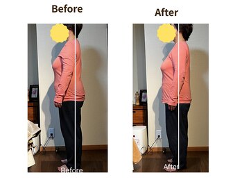 フェルナ(FERNA)/Before/After