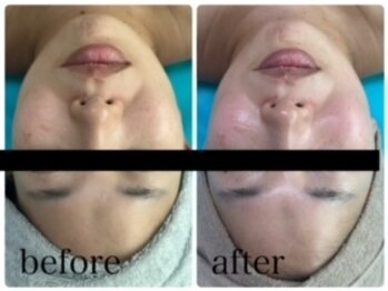 エクラニーク(Eclanique)/美肌！！！肌改善！！