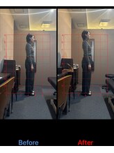 ヴレ 福岡店(Vraie)/１回の施術でもこれだけ変わる