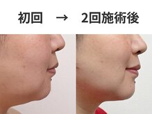 シーズボーテ(C's Beaute)