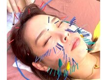 あおなみ はり きゅう整骨院