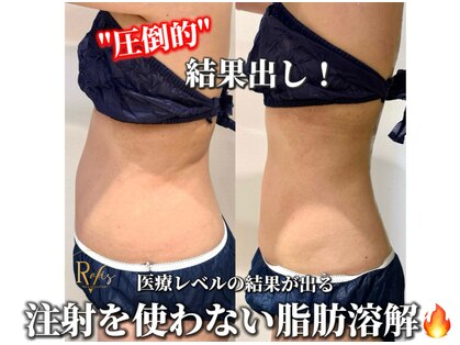 ラヴィス(ravis)の写真