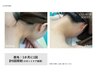 ヘアアップも綺麗に決まる!うなじ+えり足脱毛