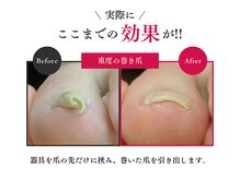 Dr.巻き爪 天神院の雰囲気（即効&仕上がり綺麗なネイルケア,フットケア☆フットマッサージも）