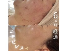 ステラ(Stella)の雰囲気（長年のお悩み改善（肌荒れ/赤み/しみ/シワ/くすみ/たるみ））