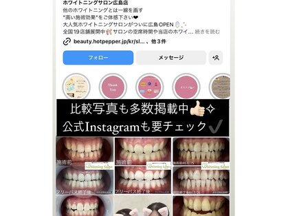 ホワイトニングサロン 広島店の写真