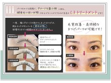 ガーデニア アイラッシュサロン(GarDeNiA)/L3毛質補修トリートメントとは.3