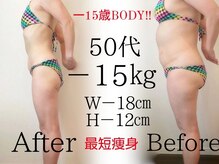 レナトゥス 銀座(Renatus)/Before&After【痩身/東京/銀座】