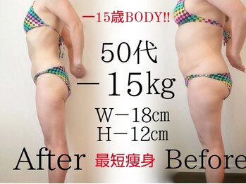 レナトゥス 銀座(Renatus)/Before&After【痩身/東京/銀座】