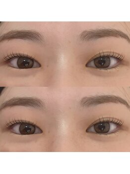 バニーアイズ 天神(Bunny eyes TENJIN)/ラッシュリフト