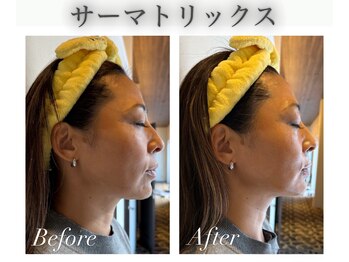 エバーグリーン(Evergreen)