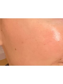 美白ケアをしたい