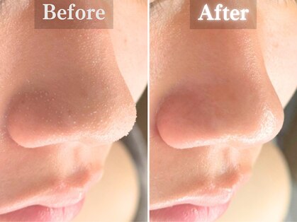 ボーンオム(Born Homme)の写真