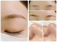 トータルビューティ ノイド(Noid)/いちご鼻撃退＋美眉毛WAX脱毛