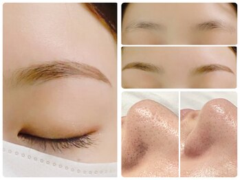 トータルビューティ ノイド(Noid)/いちご鼻撃退+美眉毛WAX脱毛