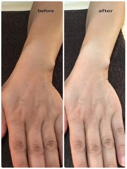 アロマ&クレイケアルーム ネロリドール(Nerolidol)/クレイハンドパック