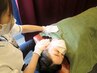 【煌めき美容鍼】美容鍼60分+猫背矯正20分/15,000円→8,800円