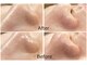 ハクミー(haku me)の写真