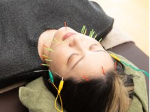 晴々/美容鍼パルス