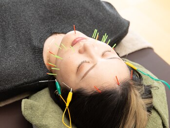 晴々/美容鍼パルス